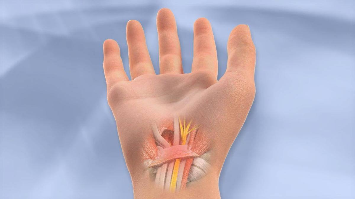 علاج التهاب الاوتار