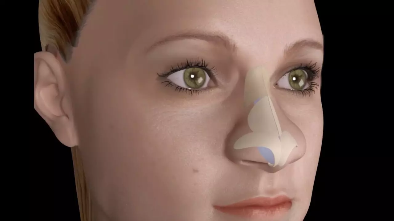 عملية تجميل شكل الأنف