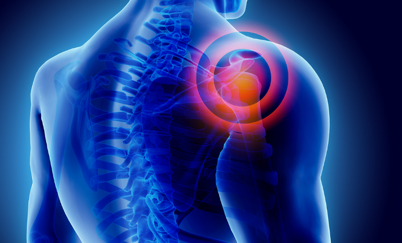  علاج التهاب الاوتار